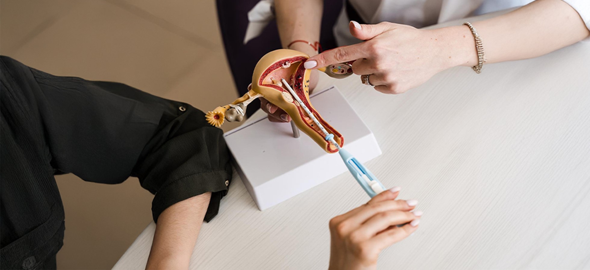 IUI Procedure: Step-by-Step Explanation, Expert Insights And What to Expect