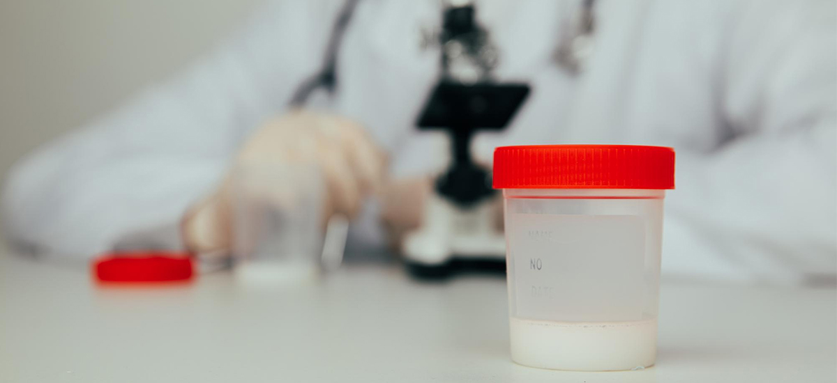 Semen Analysis Test Near Me: What It Is and Where to Get It Done