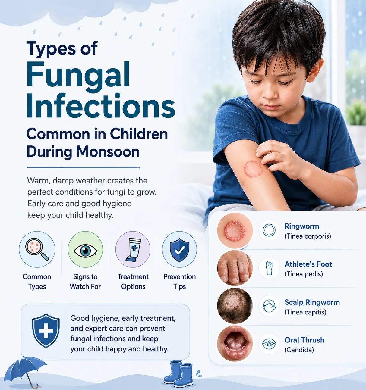 Types of Fungal Infections Common in Children During Monsoon