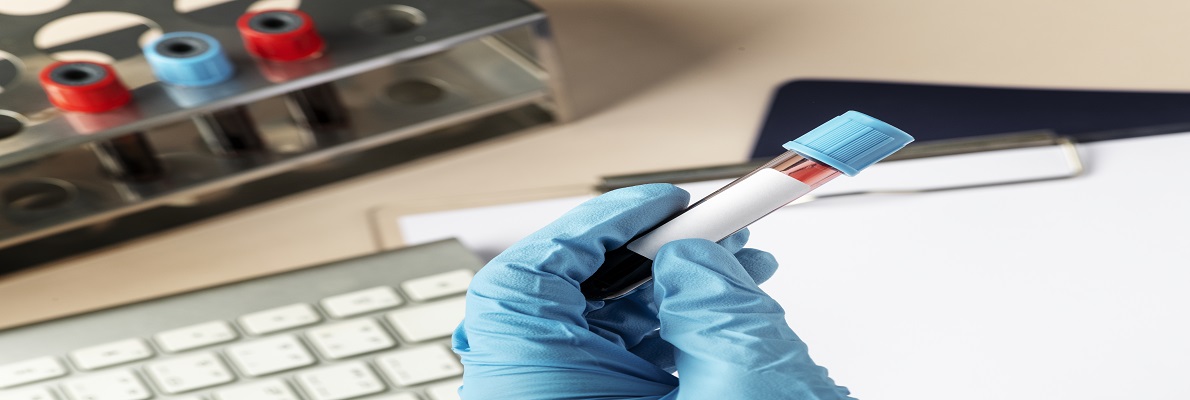 AMH Test: Purpose, Normal Range by Age, and What Your Levels Mean