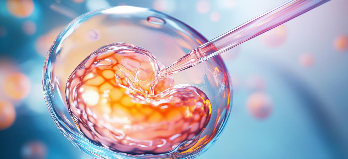 What Are the 5 Stages of IVF Treatment?