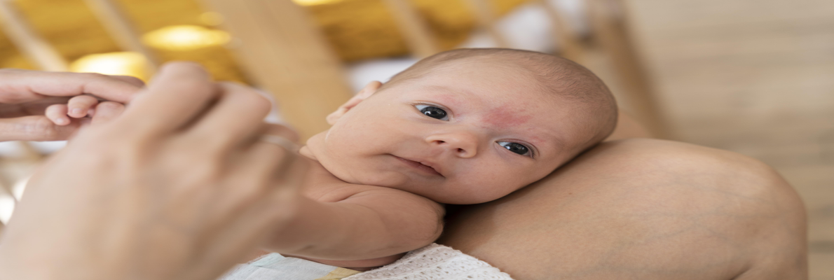 Heat Rash in Babies: A Parent's Guide to Symptoms, Types, and Quick Relief