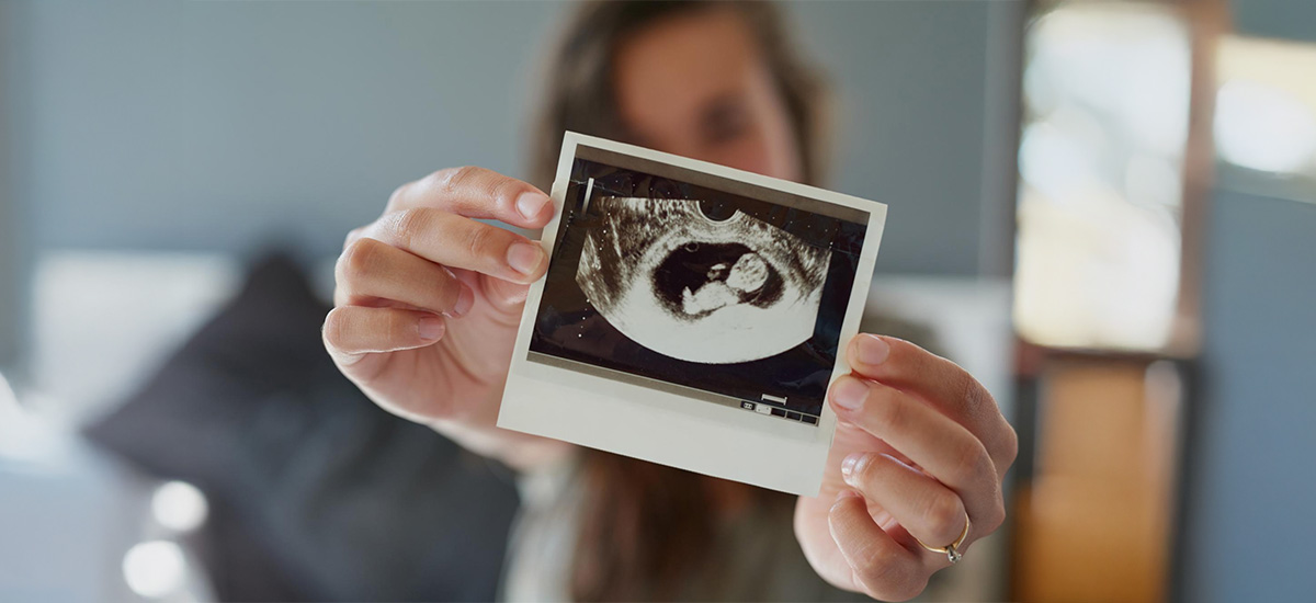 First Pregnancy Scan: what it is, when it happens, and what it can (and can’t) tell you