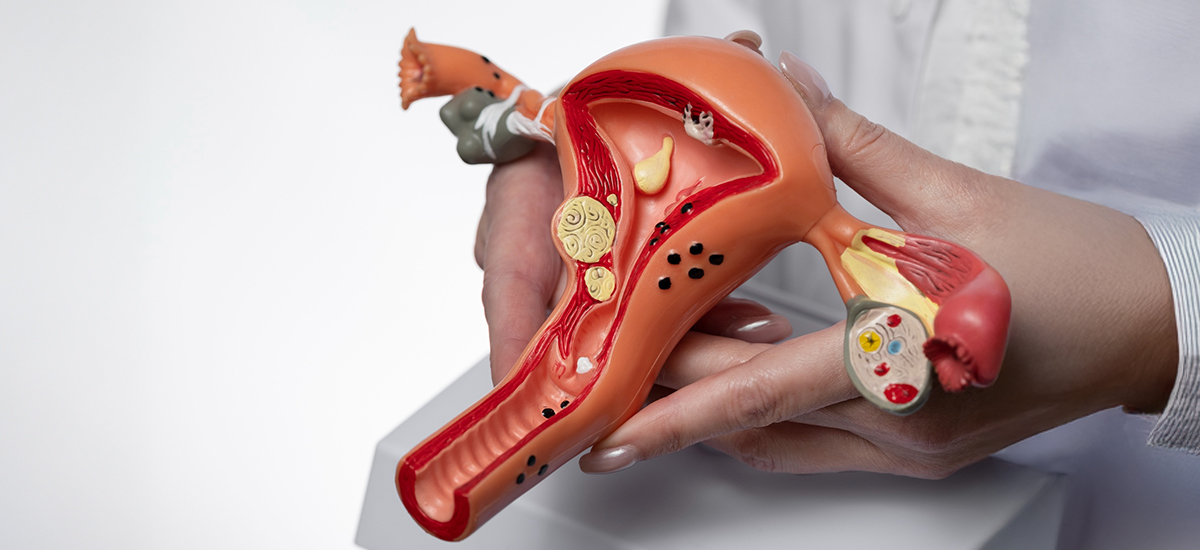 Fibroids During Pregnancy: Causes, Risks, and a Calm, Step-by-Step Plan